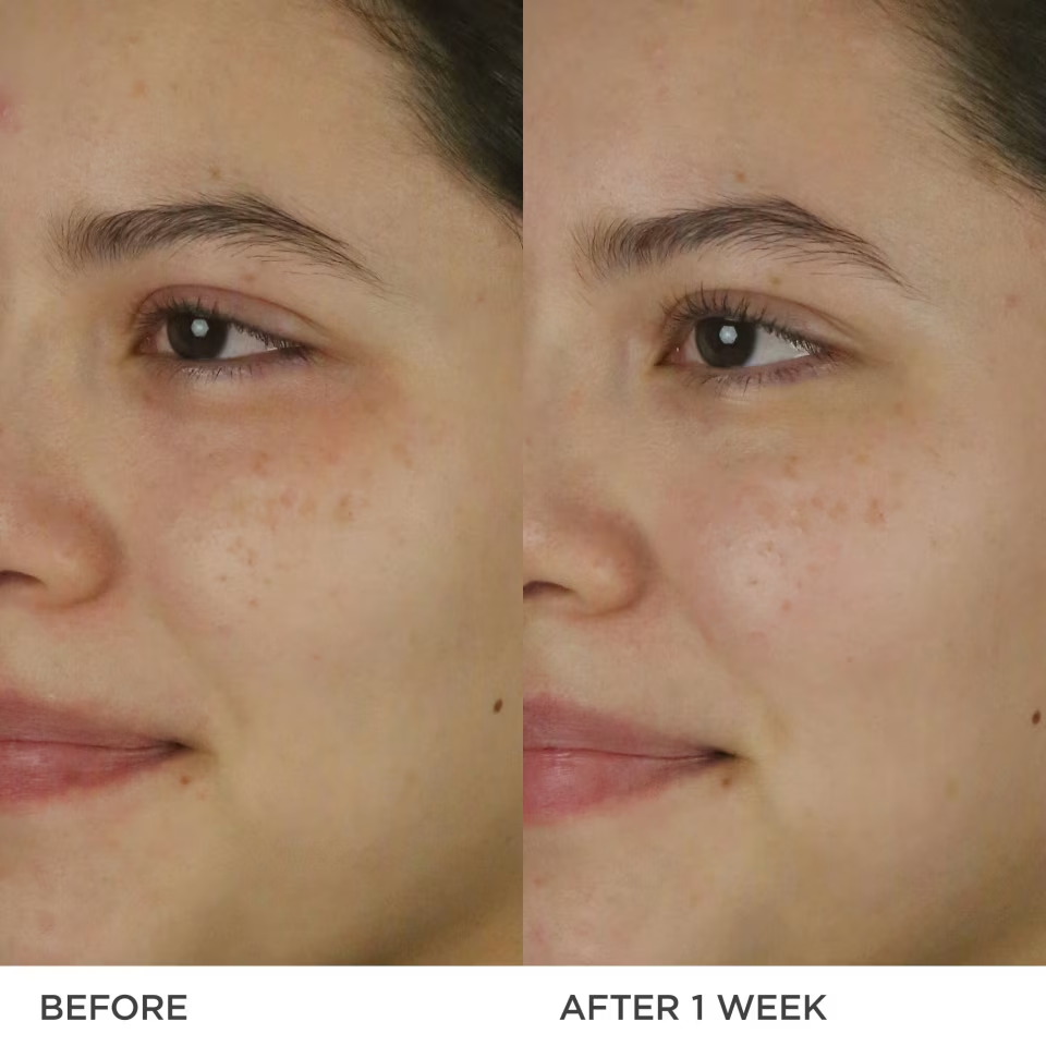 🔥The Dewy Milk Moisturizer Lightweight Glowing Hydration✨