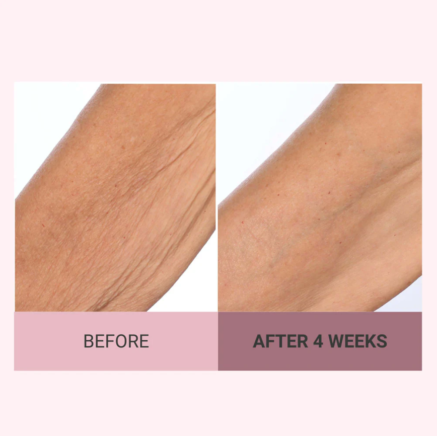 👩🦱Experience Ultimate Luxury - 50% OFF - ✨Champagne Beaute Lift Firming Body Creme For Firmer, Smoother,Radiant Skin! ✨*(Buy3 & Free Shipping)
