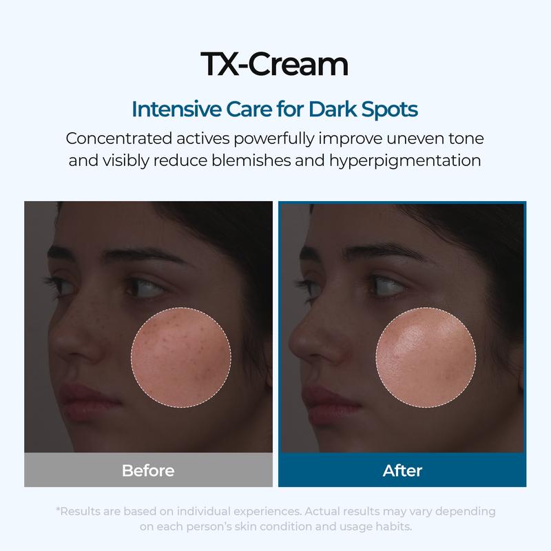TX Cream 50ml Nano-sized Tranexaminc Acid for Dark Spots & Hyperpigmentation