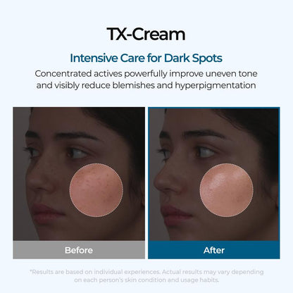 TX Cream 50ml Nano-sized Tranexaminc Acid for Dark Spots & Hyperpigmentation