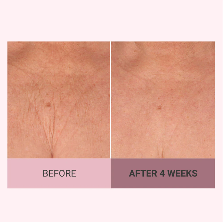 👩‍🦱Experience Ultimate Luxury - 50% OFF - ✨Champagne Beaute Lift Firming Body Creme For Firmer, Smoother,Radiant Skin! ✨*(Buy3 & Free Shipping)