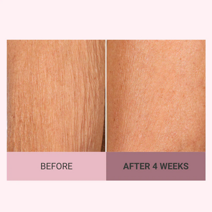 👩‍🦱Experience Ultimate Luxury - 50% OFF - ✨Champagne Beaute Lift Firming Body Creme For Firmer, Smoother,Radiant Skin! ✨*(Buy3 & Free Shipping)