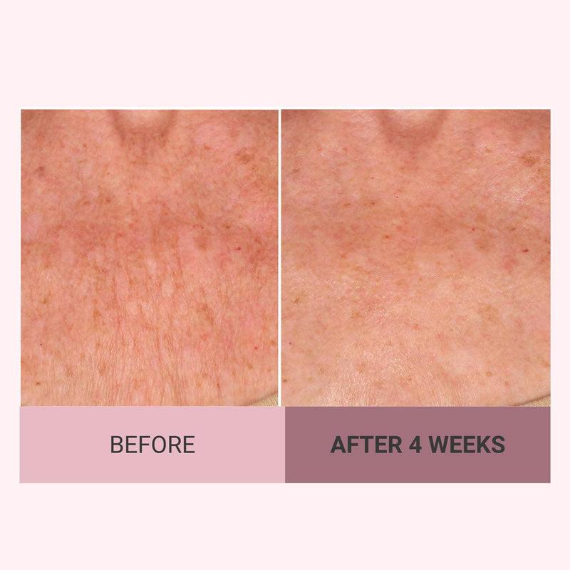 👩‍🦱Experience Ultimate Luxury - 50% OFF - ✨Champagne Beaute Lift Firming Body Creme For Firmer, Smoother,Radiant Skin! ✨*(Buy3 & Free Shipping)