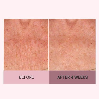 👩‍🦱Experience Ultimate Luxury - 50% OFF - ✨Champagne Beaute Lift Firming Body Creme For Firmer, Smoother,Radiant Skin! ✨*(Buy3 & Free Shipping)