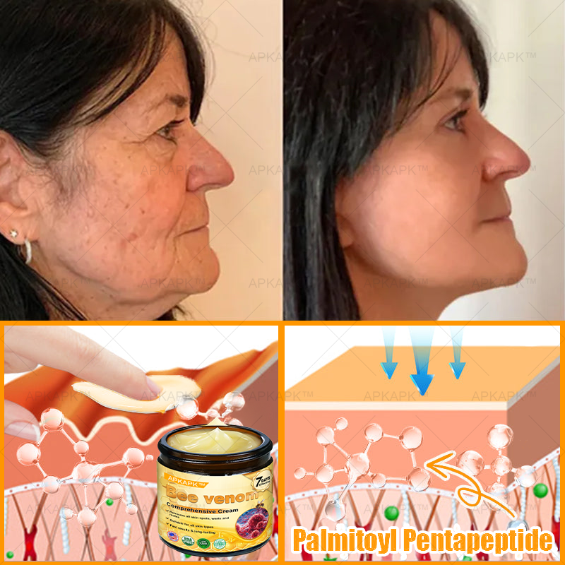 Made and Shipped from USA ✨ APKAPK® Bee venom Comprehensive Cream 🔥 LAST DAY 80% OFF 💎💎