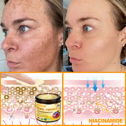 Made and Shipped from USA ✨ APKAPK® Bee venom Comprehensive Cream 🔥 LAST DAY 80% OFF 💎💎